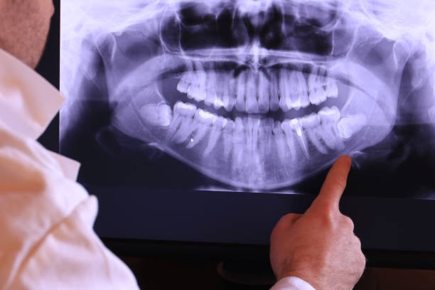 Best Emergency Tooth Extraction in Skidway Lake, MI
