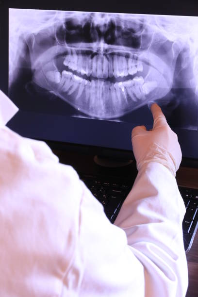 Best Emergency Broken Tooth Repair in Skidway Lake, MI